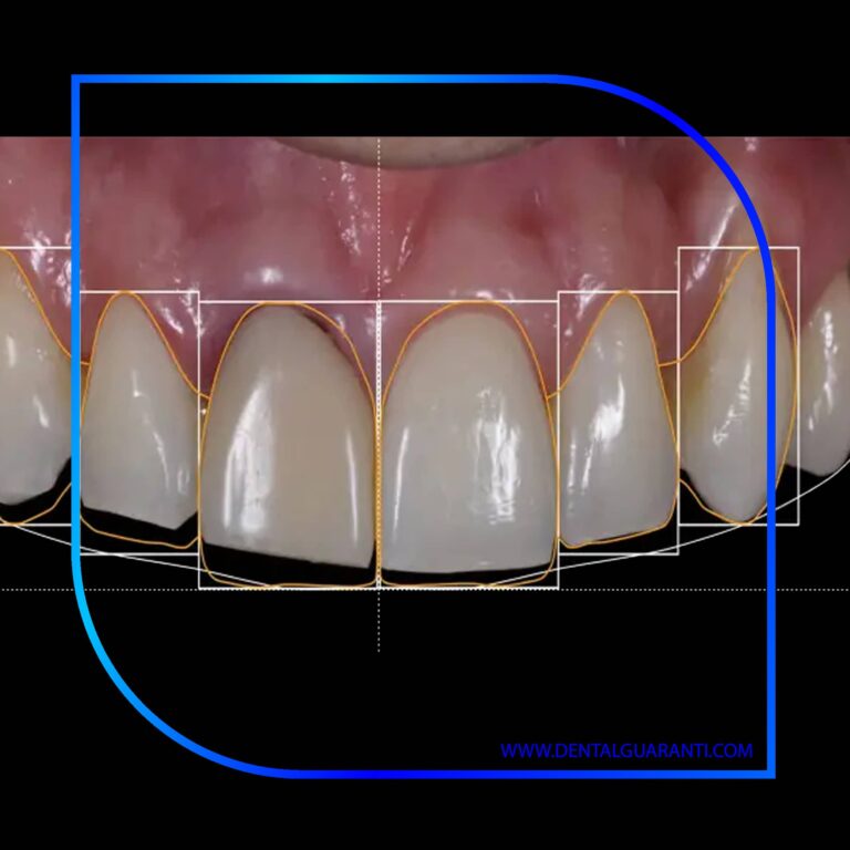 بهترین ابزارهای دیجیتال برای طراحی لبخند
