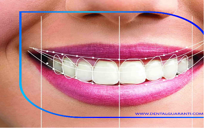 طراحی لبخند دیجیتال چیست