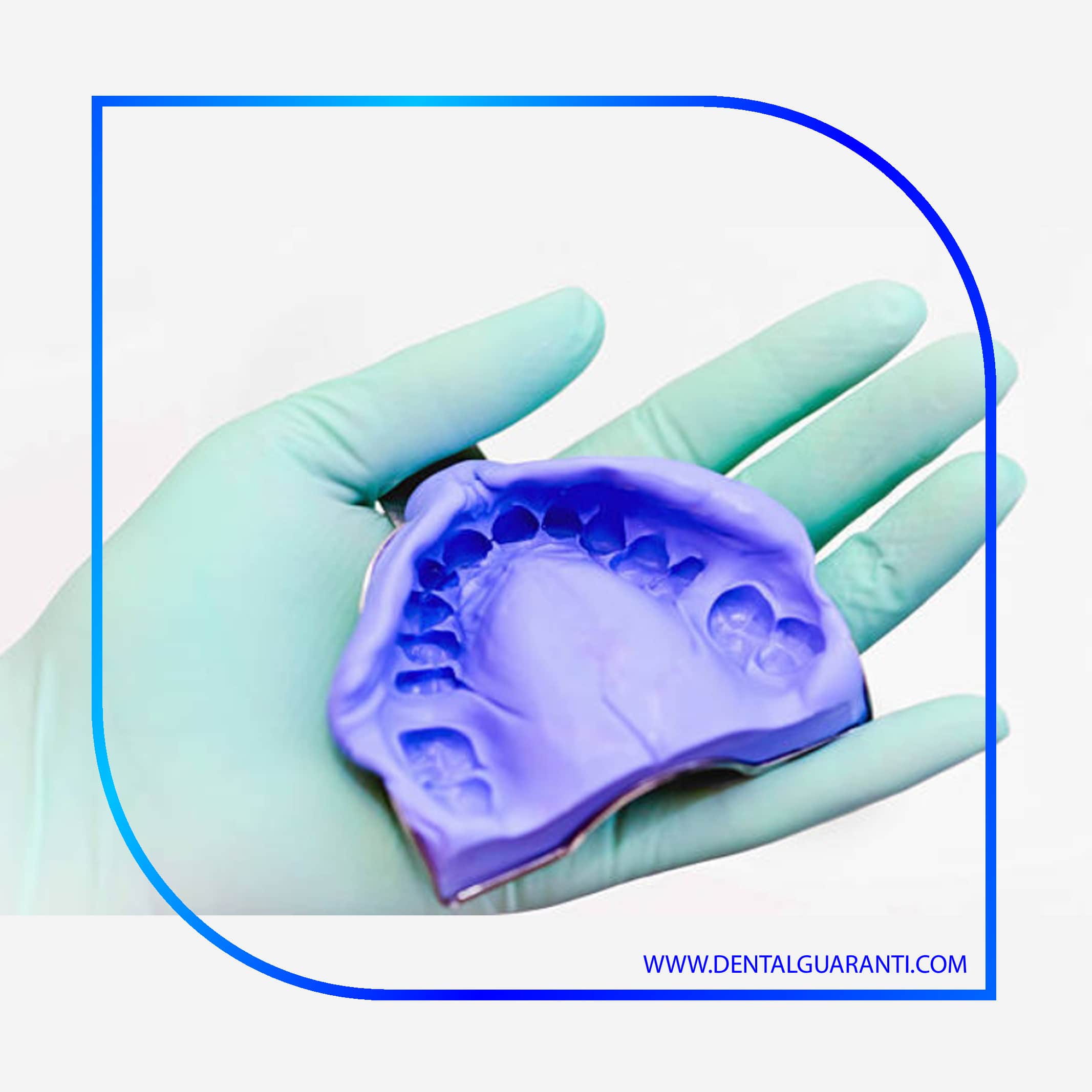 تکنیک های قالب گیری دندان شکسته و مقایسه روش ها