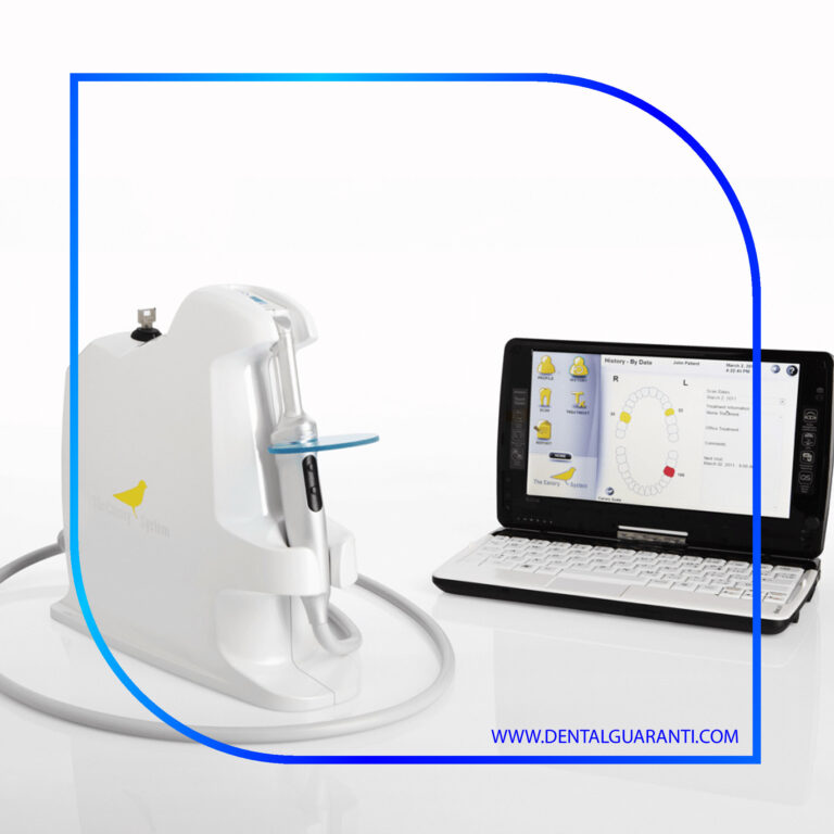 روش‌های نوین برای تشخیص اولیه پوسیدگی با تجهیزات جدید