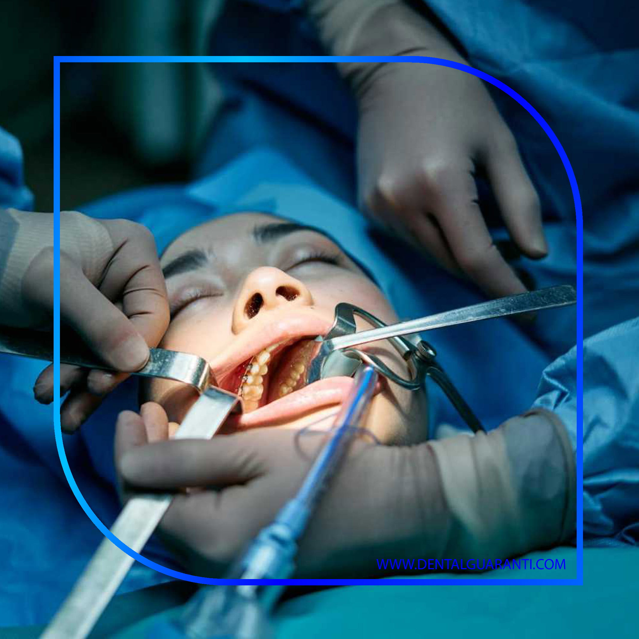 شناخت فناوری لیزر در جراحی‌های بافت نرم دهان