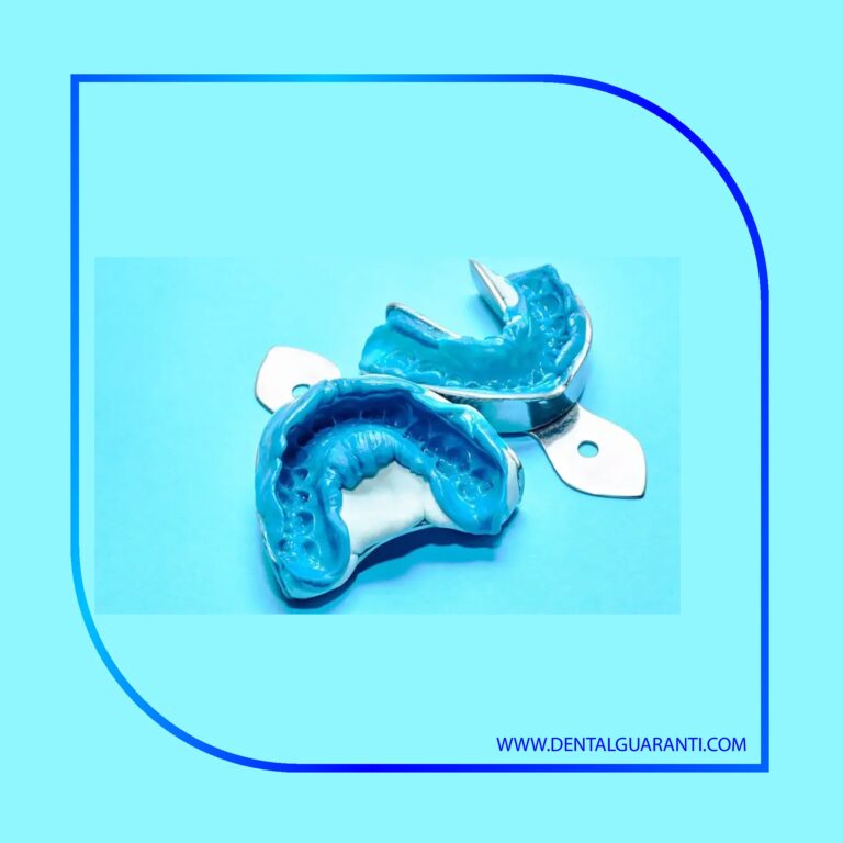 فرآیند قالب گیری دندان شکسته