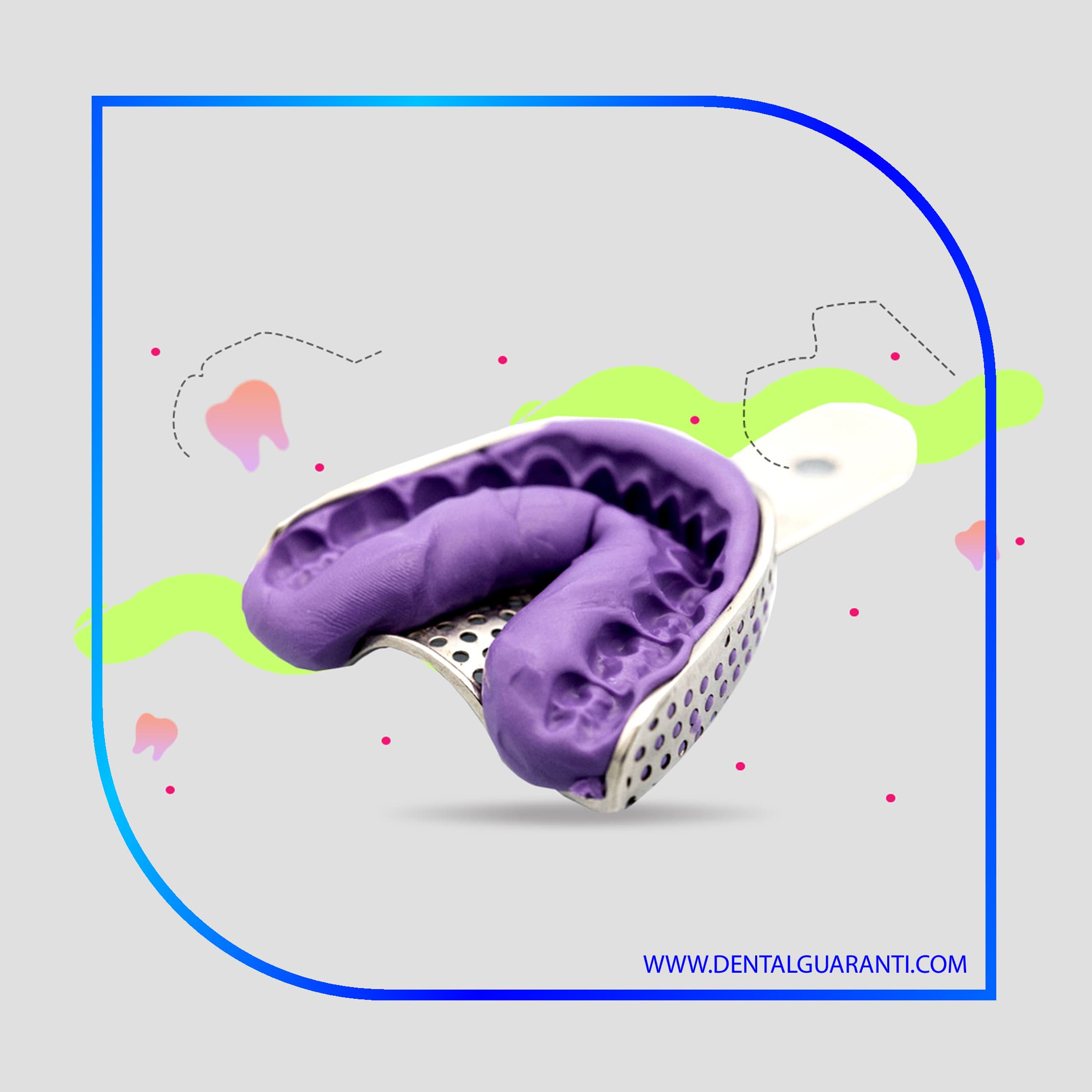 مراحل آماده سازی دهان برای قالب گیری دندان